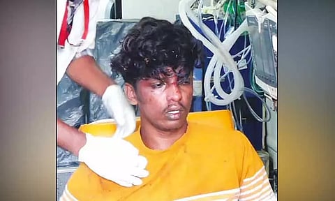 கொடைக்கானல் வனப்பகுதியில் 100 அடி பள்ளத்தில் தவறி விழுந்த கல்லூரி மாணவர்; மரக்கிளையை பிடித்து உயிர் தப்பினார்