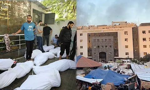 நிர்கதியற்று தவிக்கும் காசா மருத்துவமனை... மொத்தமாக புதைக்கப்பட்ட 179 சடலங்கள்