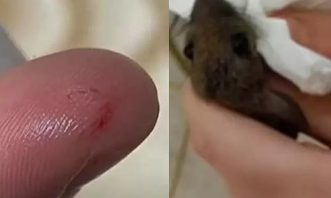 தன்னை கடித்த எலியை பழிவாங்கிய கல்லூரி மாணவி