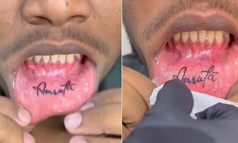 உதட்டில் காதலியின் பெயரை டாட்டூவாக குத்திய காதலன்