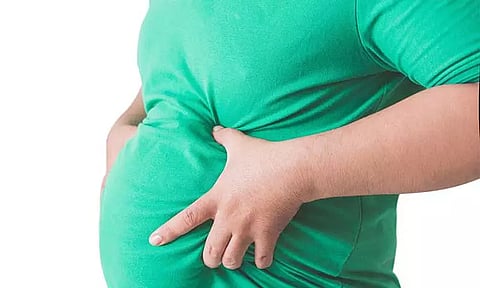 உலகளவில் 100 கோடிக்கும் அதிகமானோர் உடல் பருமனால் பாதிப்பு - லான்செட் ஆய்வில் தகவல்