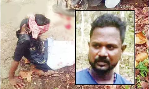 மனைவியின் கால்களை சுத்தியலால் அடித்து உடைத்த கொடூர கணவன்