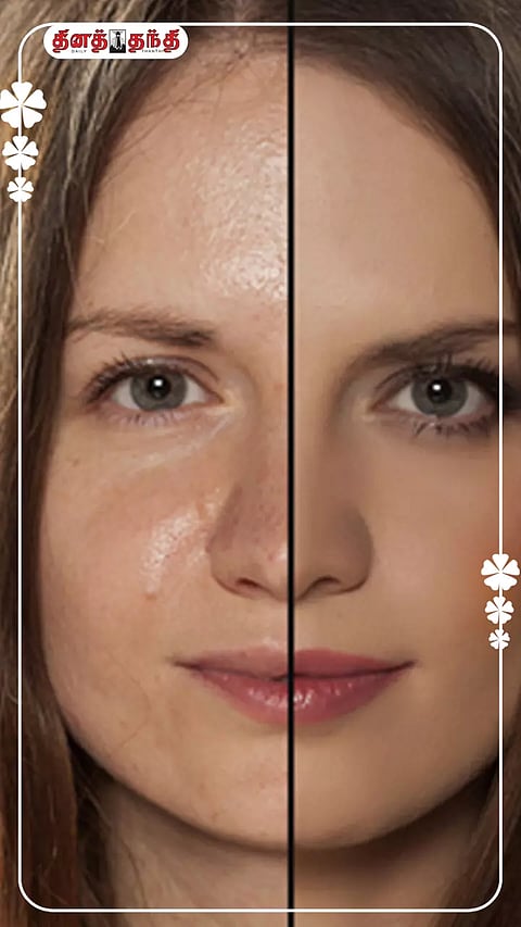 முகத்தில் எண்ணெய் வடிய காரணங்கள் என்ன?