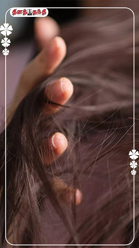 கூந்தல் வெடிப்பை தடுக்கும் வழிமுறைகள்..!