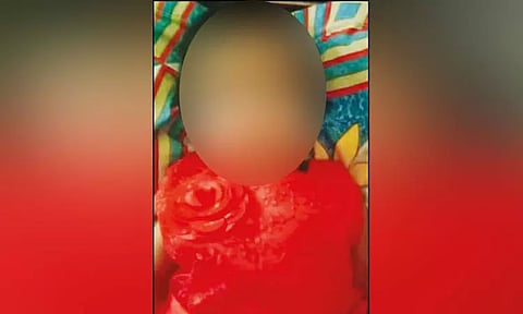 டெங்கு காய்ச்சலுக்கு 5 மாத பெண் குழந்தை உயிரிழப்பு