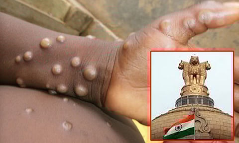 குரங்கம்மை தடுப்பு முன்னெச்சரிக்கை நடவடிக்கை: மாநிலங்களுக்கு மத்திய அரசு கடிதம்