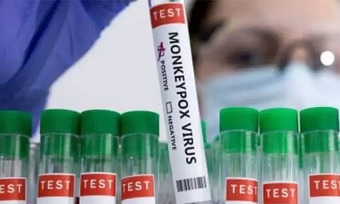 இந்தியாவில் ஒருவருக்கு எம்-பாக்ஸ் உறுதி