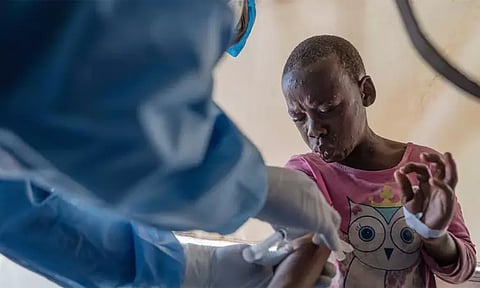 எம்-பாக்ஸ் தடுப்பூசிக்கு உலக சுகாதார அமைப்பு ஒப்புதல்