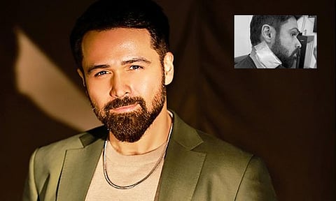 Popular Bollywood actor injured during shooting