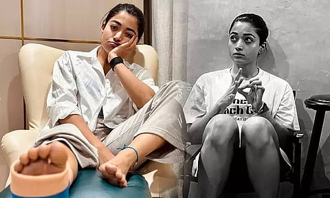 உடற்பயிற்சியின்போது காலில் காயம் - புகைப்படங்களை பகிர்ந்த ராஷ்மிகா மந்தனா