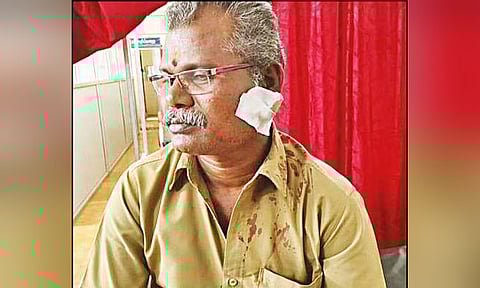 காயம் அடைந்த கண்டக்டர் மாடசாமி.