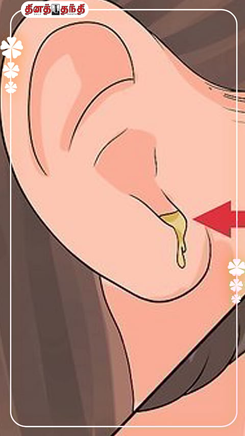 காதில் இருந்து சீழ் வடிகிறதா..?