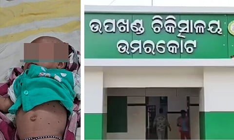 தீய சக்தி புகுந்துவிட்டதாக பச்சிளம் குழந்தைக்கு இரும்பு கம்பியால் 40 முறை சூடு வைத்த குடும்பத்தினர்