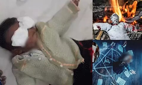 மூடநம்பிக்கையின் உச்சம்: ஆவி புகுந்துள்ளதாக தீயின்முன் கட்டி தொங்கவிடப்பட்ட 6 மாத குழந்தை; கண் பார்வை பாதிப்பு