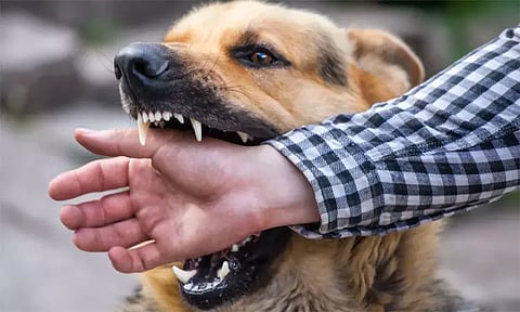 நாய் கடித்தவுடன் ரேபிஸ் தடுப்பூசி செலுத்திக்கொள்வது அவசியம்: பொது சுகாதாரத்துறை