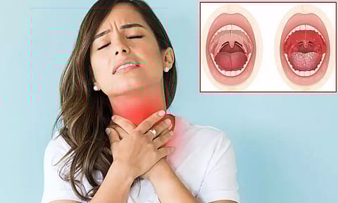 தாங்க முடியாத வலியை ஏற்படுத்தும்.. ஆனாலும் டான்சில் நல்லது