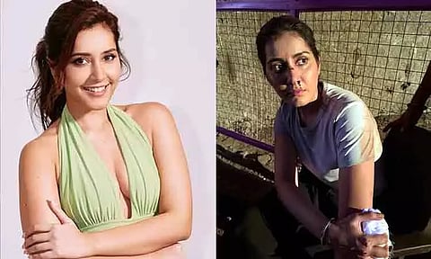 ராஷி கன்னாவிற்கு என்ன ஆச்சு?.. ரத்த காயத்துடன் இன்ஸ்டாவில் புகைப்படம் பதிவு