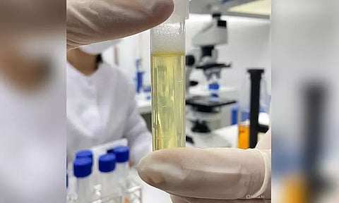 சிறுநீர் வெள்ளையாக நுரையுடன் வெளியேறினால் ஆபத்தா?