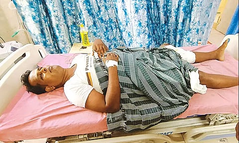 அலட்சியத்தால் வந்த வினை: வலது காலுக்கு பதிலாக இடது காலுக்கு சிகிச்சை செய்த டாக்டர்கள் - கண்டக்டர் அதிர்ச்சி