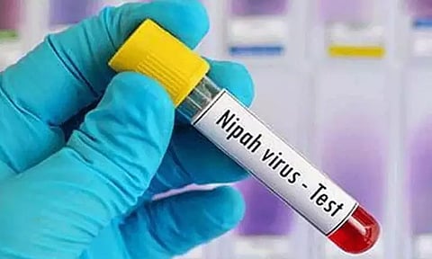 தமிழகத்தில் 'நிபா' வைரஸ் இல்லை- பொதுசுகாதாரத்துறை