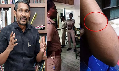 ஏன் கைது செய்கிறீர்கள்? என கேள்வி கேட்ட இருவரை போலீசார் தாக்கியுள்ளனர்: வன்னி அரசு