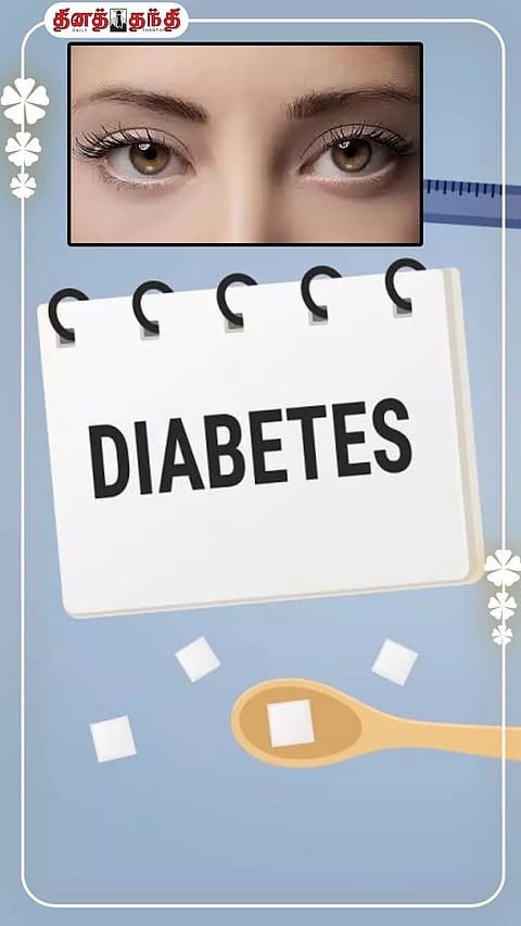 டயாபட்டீஸ் வந்த உடனே கண்பார்வை பறிபோகுமா?