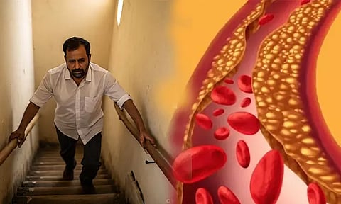 உடலில் கெட்ட கொழுப்பு அதிகரித்தால் இந்த உறுப்புகள் எச்சரிக்கை செய்யும்