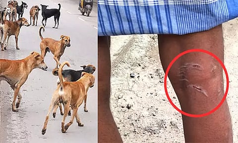 தூத்துக்குடியில் தெரு நாய்கள் கடித்து மக்கள் பாதிப்பு: மாநகராட்சி நடவடிக்கை எடுக்க கோரிக்கை