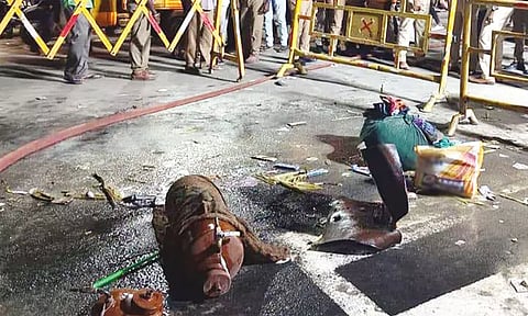 சிலிண்டர் வெடித்து விபத்து: பலூன் கடை உரிமையாளர் மீது வழக்குப்பதிவு