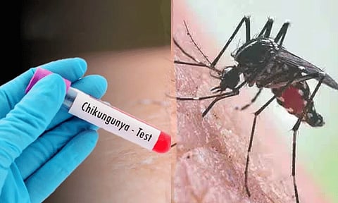 தமிழகத்தில் அதிகரிக்கும் சிக்குன் குனியா பாதிப்பு.. பொது சுகாதாரத்துறை எச்சரிக்கை.!