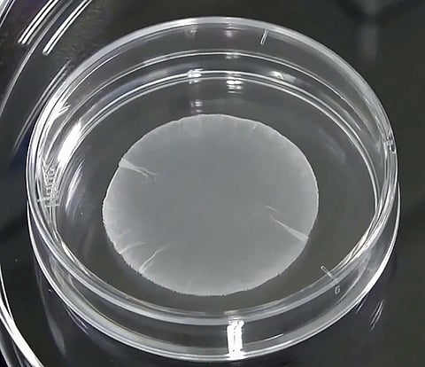 File photo shows a cardiac muscle sheet derived from induced pluripotent stem cells.