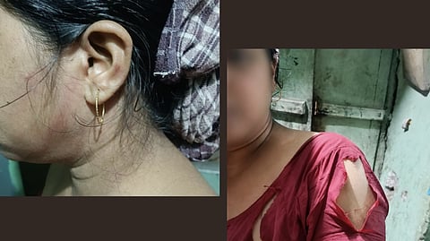 A Christian resident in Paschim Medinipur was sexually assaulted allegedly by Bajrang Dal activists.