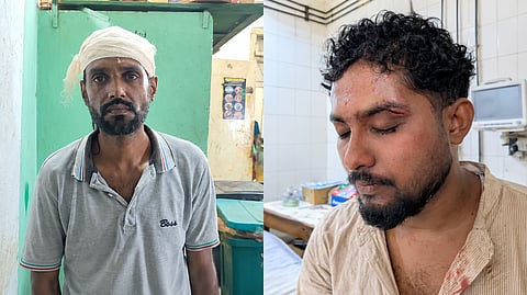 The two injured journalists, Reza Rubel of Shyamol Sylhet and Nibendu Talukdar of SylhetView24.com, are receiving treatment at Sylhet MAG Osmani Medical College Hospital after an alleged attack by intern doctors on Wednesday night.