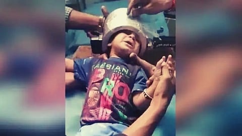 The child's head stuck in the pressure cooker while playing