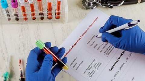 Here are 5 important health tests that women over 30 should do