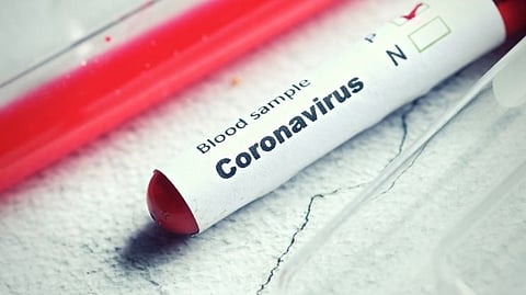 Goa Corona Updates
