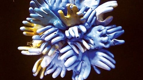 मानवी आक्रमणाच्या दुर्दैवी प्रतिमा