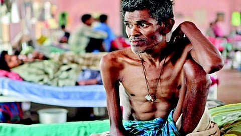 tb health department