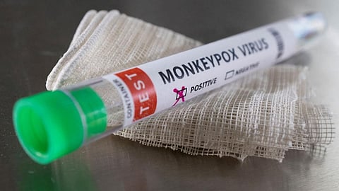 monkeypox