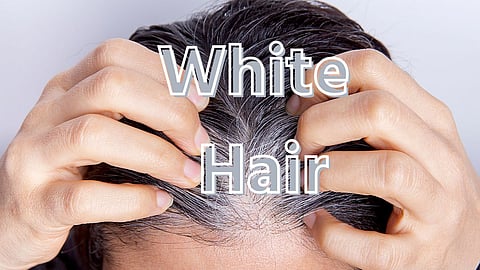 White Hair