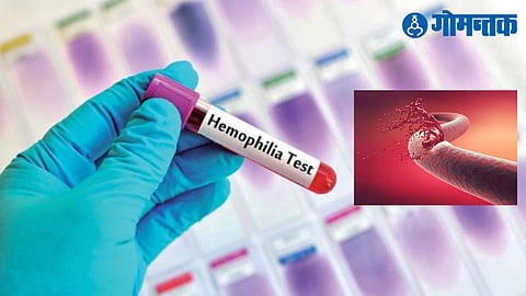 Most Expensidve Medicene