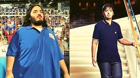Anant Ambani Weight Loss