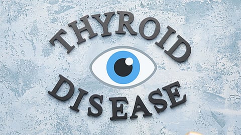 Thyroid Eye Disease