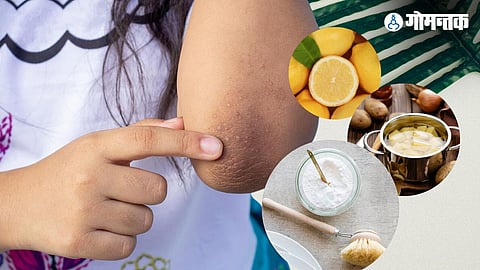 How To Lighten Elbows