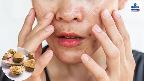 Monsoon Care For Oily Skin