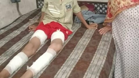 Ludhiana Kindergarten student brutally beaten for a minor mistake, accused teacher jailed.