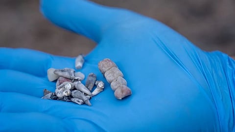 israel hamas war in gaza shared teeth bones of children burnt