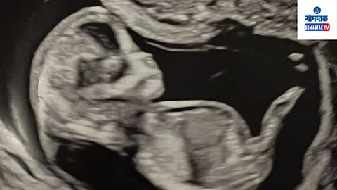 Sex-Selective abortion in Bengaluru.