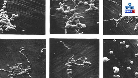 M Pneumonia| AIIMS Delhi| India