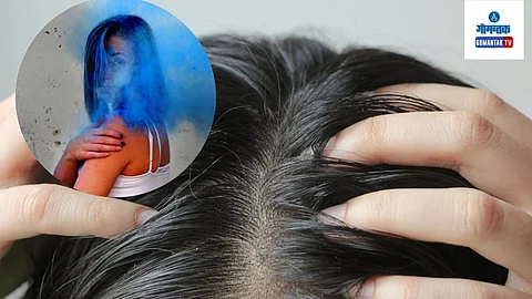 Scalp Care